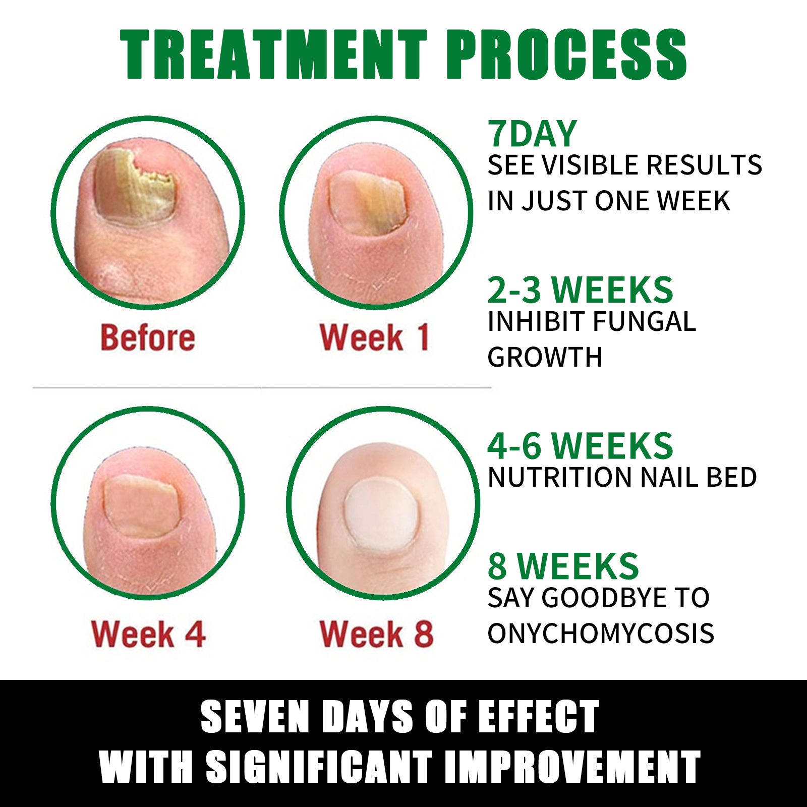 Treatment process chart for fungal nail infection with before and after images and timeframes.