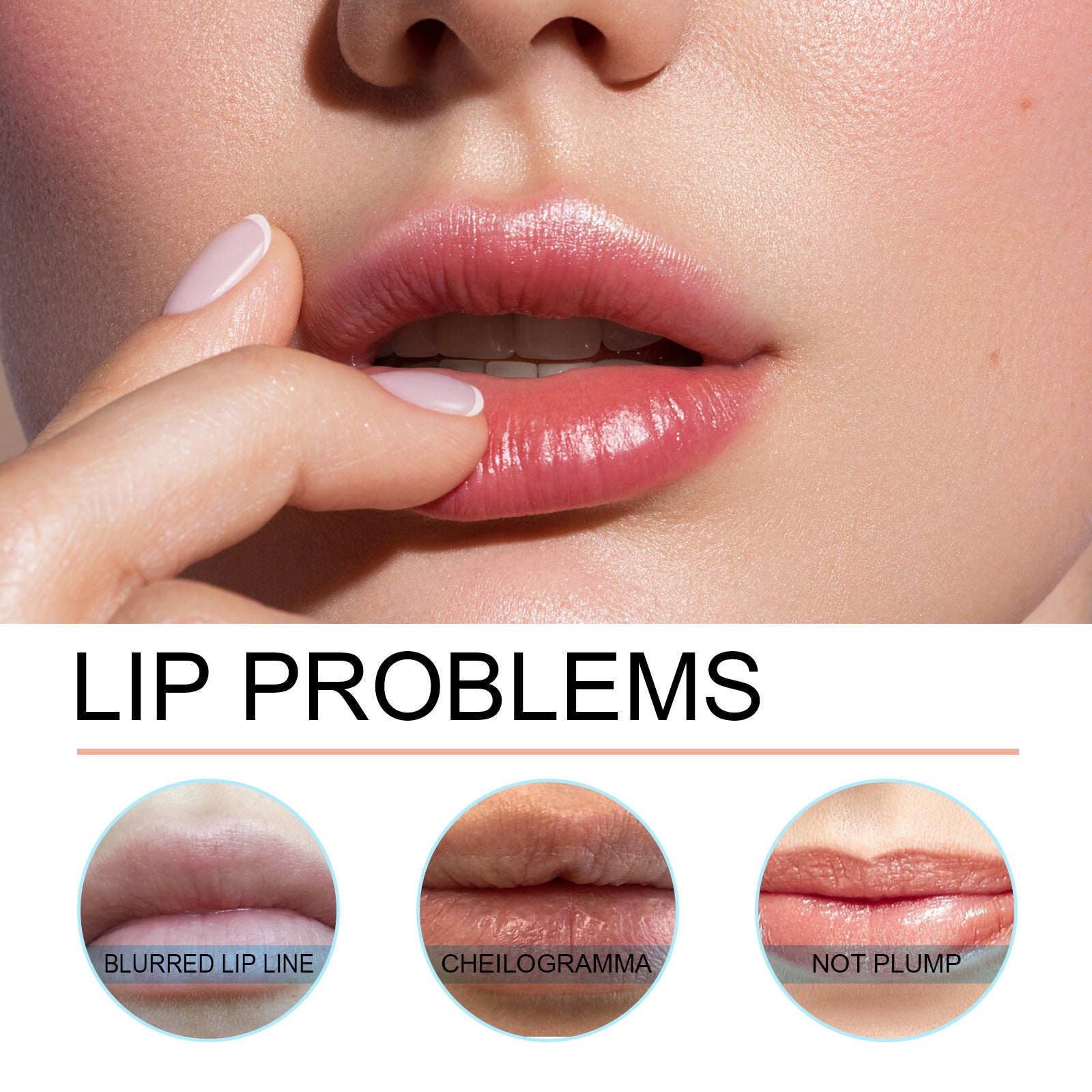 Close-up of lips with text 'Lip Problems' and three smaller images below showing issues like blurred lip line, cheilogramma, and not plump.