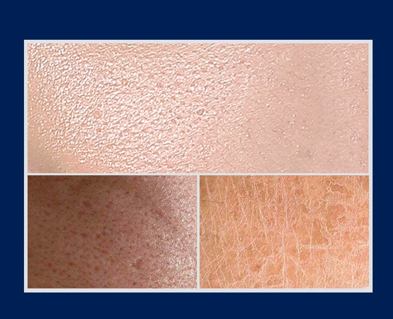 Collage of three different skin texture images on a blue background