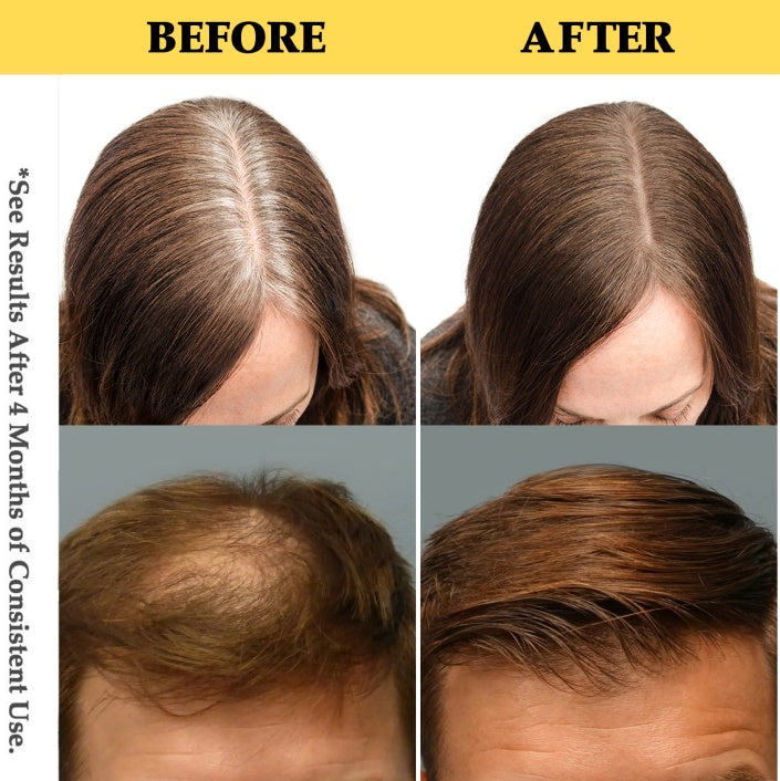 Before and after hair treatment comparison showing scalp and hair health improvement.