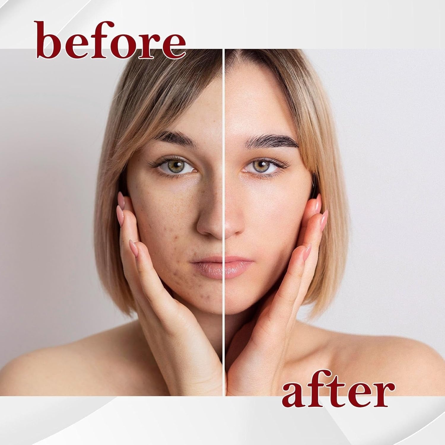 Before and after comparison of a woman's face with visible skin improvement.