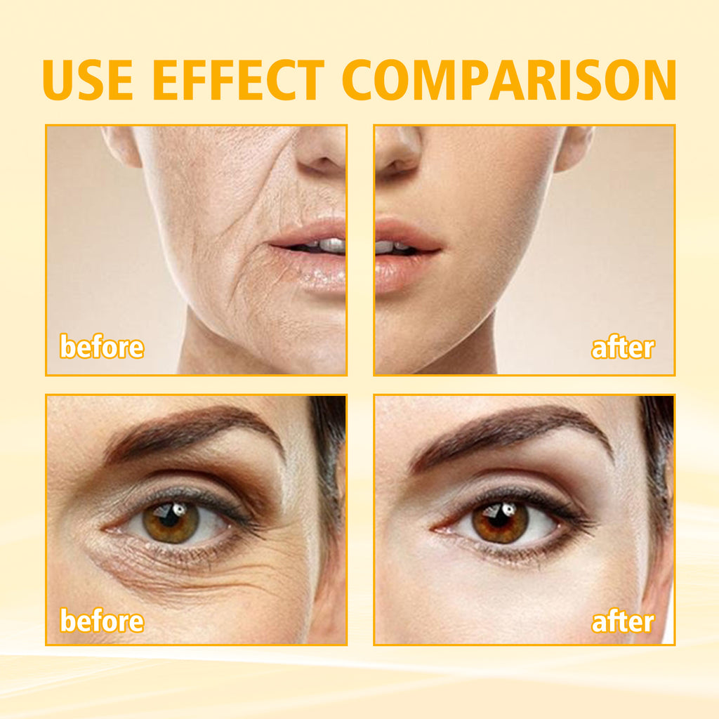 Before and after comparison of facial features with a focus on skin texture and eye area.