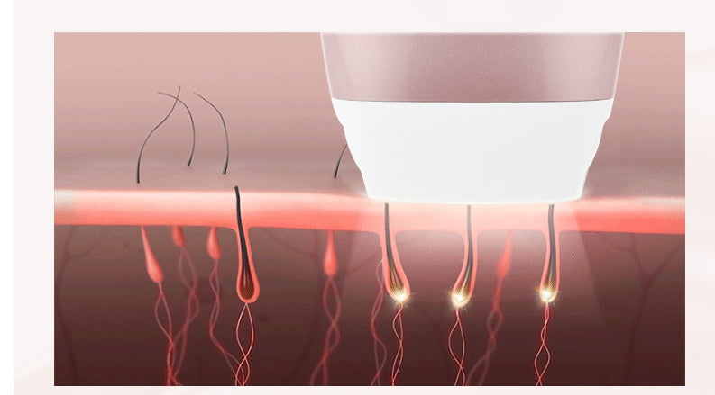 Illustration of hair follicles with a close-up view of red light energy being applied.
