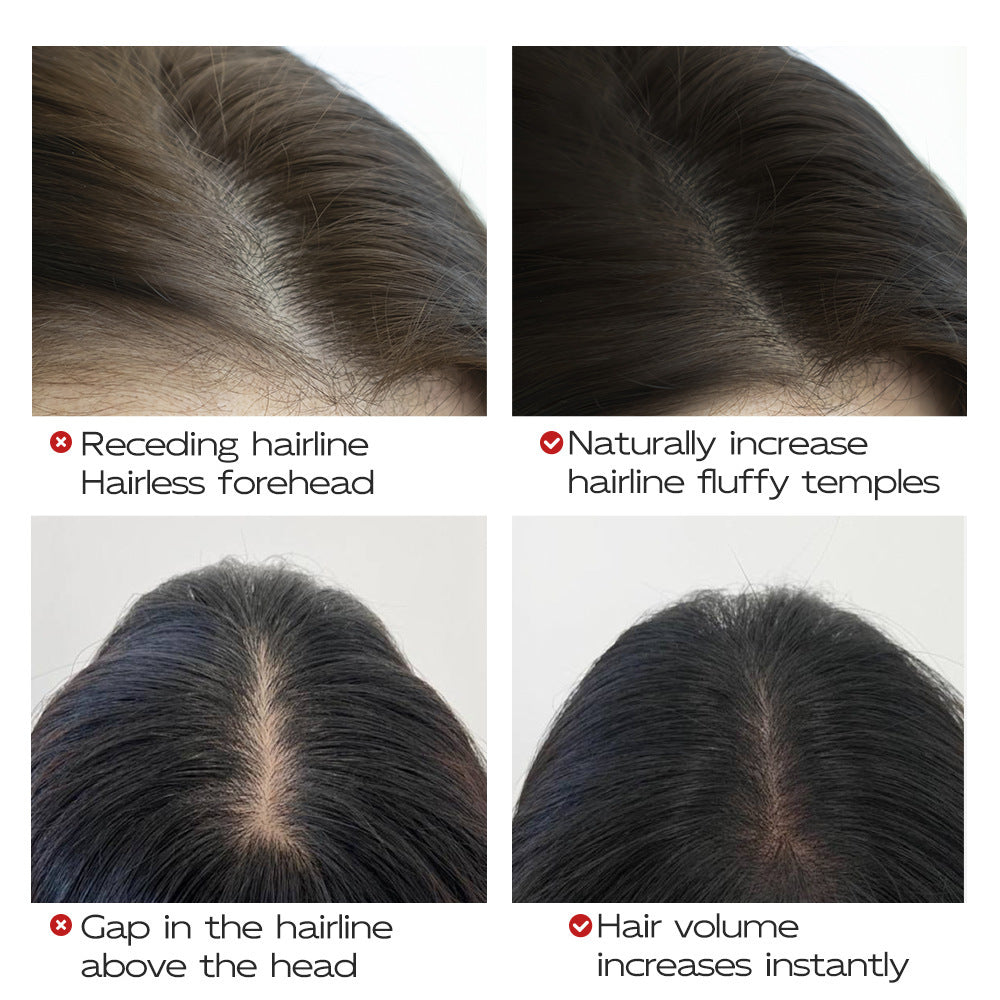 Before and after comparison of hairline and scalp treatment with text labels.