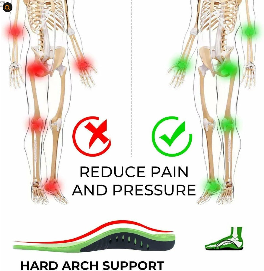 Illustration of a skeleton with red spots indicating pain on one side and green spots on the other, with text about hard arch support.