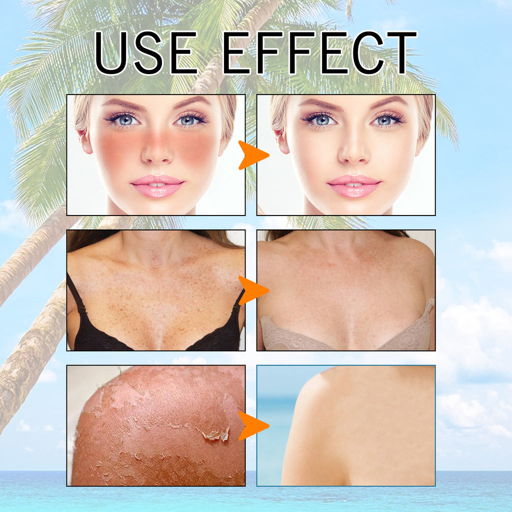 Before and after effects of a skincare product with palm tree and beach background