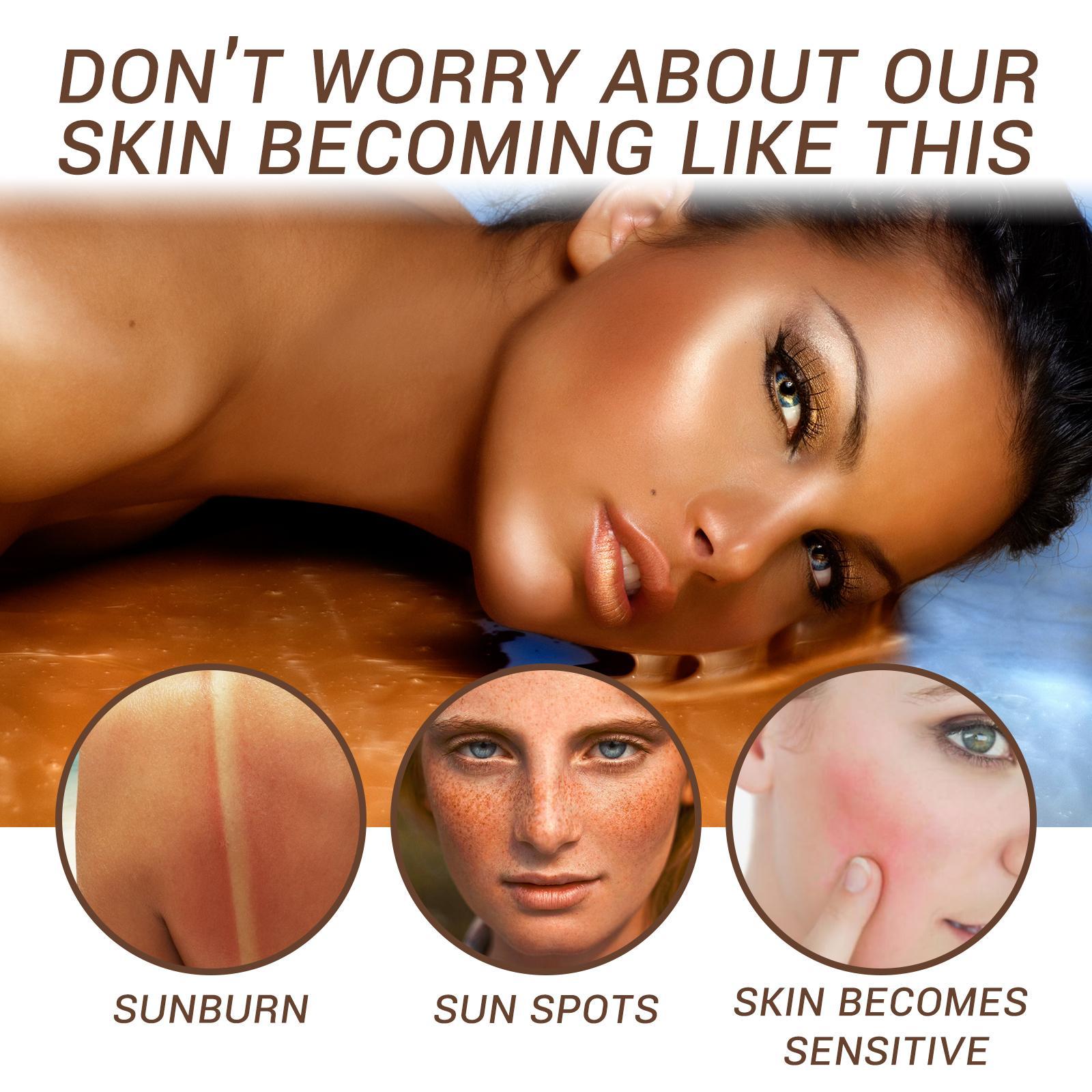 Woman lying down with close-ups of sunburn, sun spots, and sensitive skin on a white background.