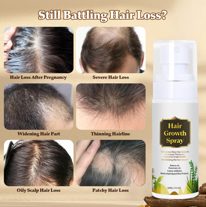Advertisement for hair growth spray showing before-and-after images of hair loss issues.